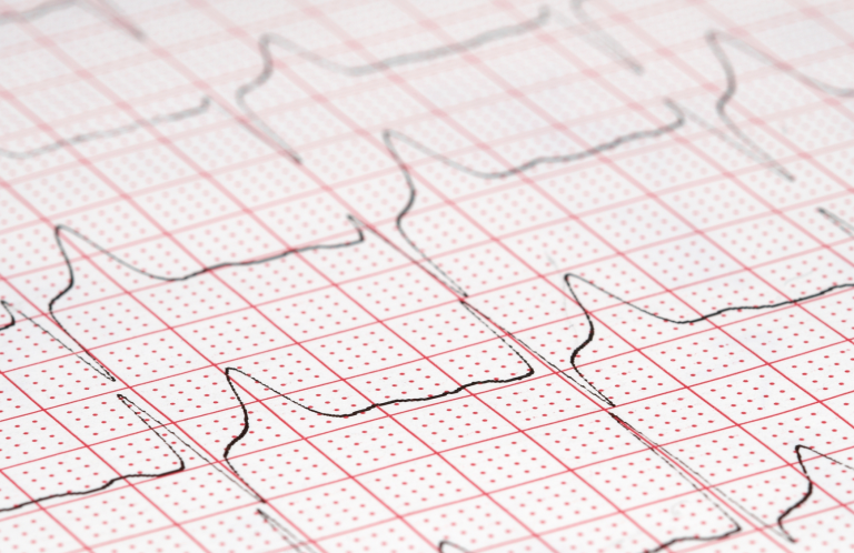 Blood Glucose Monitoring and Insulin Administration Medical instruments including a stethoscope and pen-like devices on a light background.