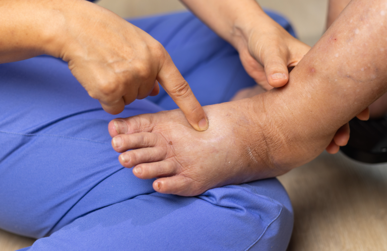 Diabetic Foot Assessment A person receiving foot care, with hands pointing to the ankle area.